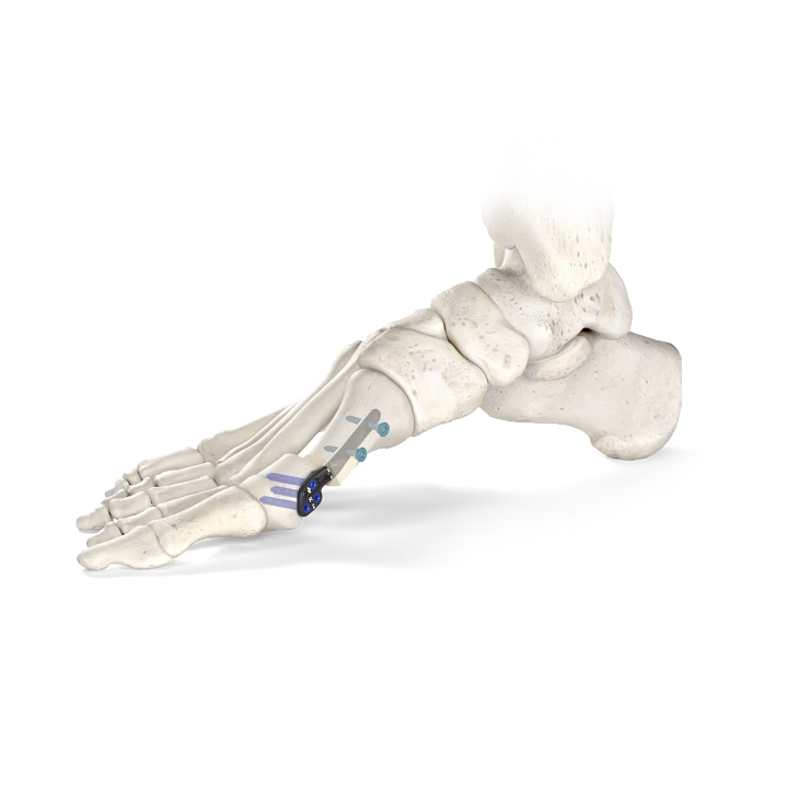 product_img1