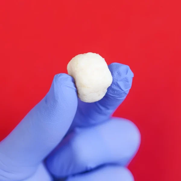 OssiGraft Prime™ - Image 3