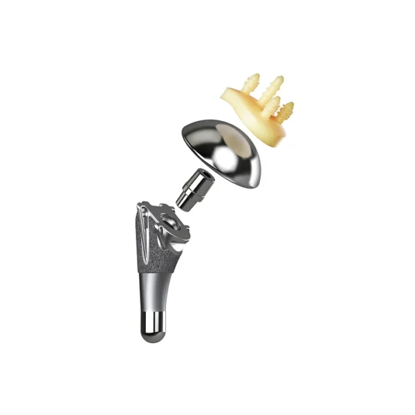 AltiVate® Anatomic - Image 7