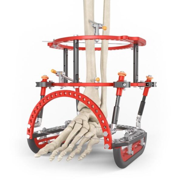 EF1 Circular Frame