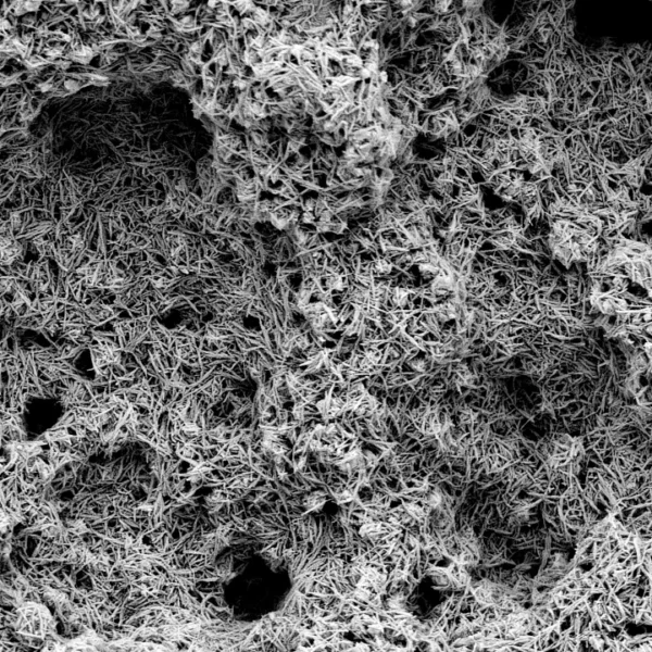 EMPOWR Porous™ Knee - Image 2